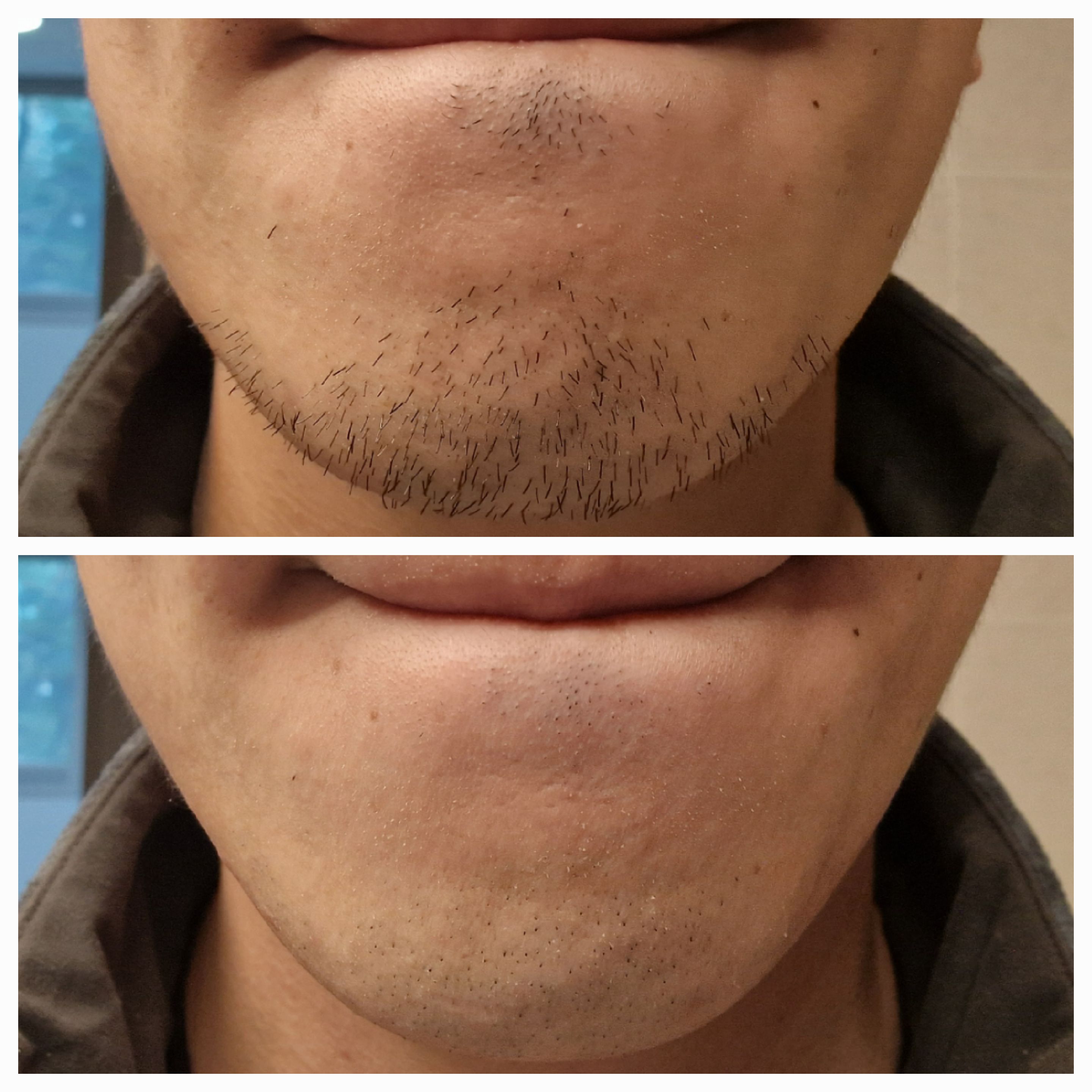 Before & After